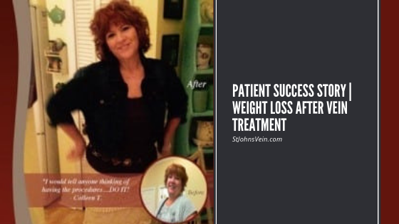 Patient Success Story _ Weight loss After Vein Treatment
