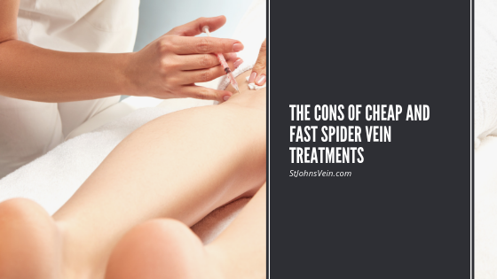 The Cons of Cheap and Fast Spider Vein Treatments