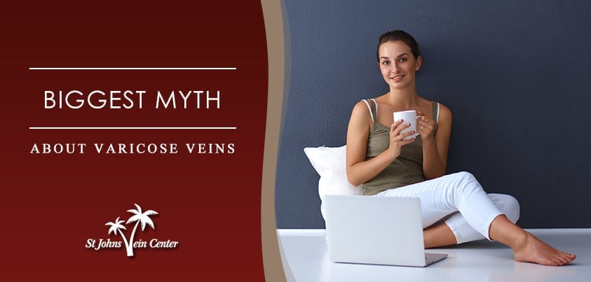 biggest varicose vein myths