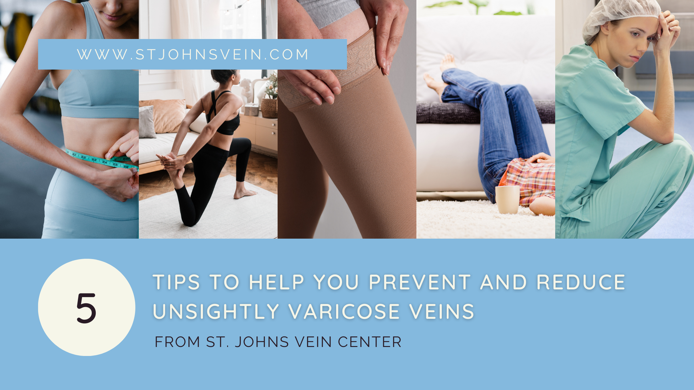 5 Tips To Help You Prevent And Reduce Unsightly Varicose Veins