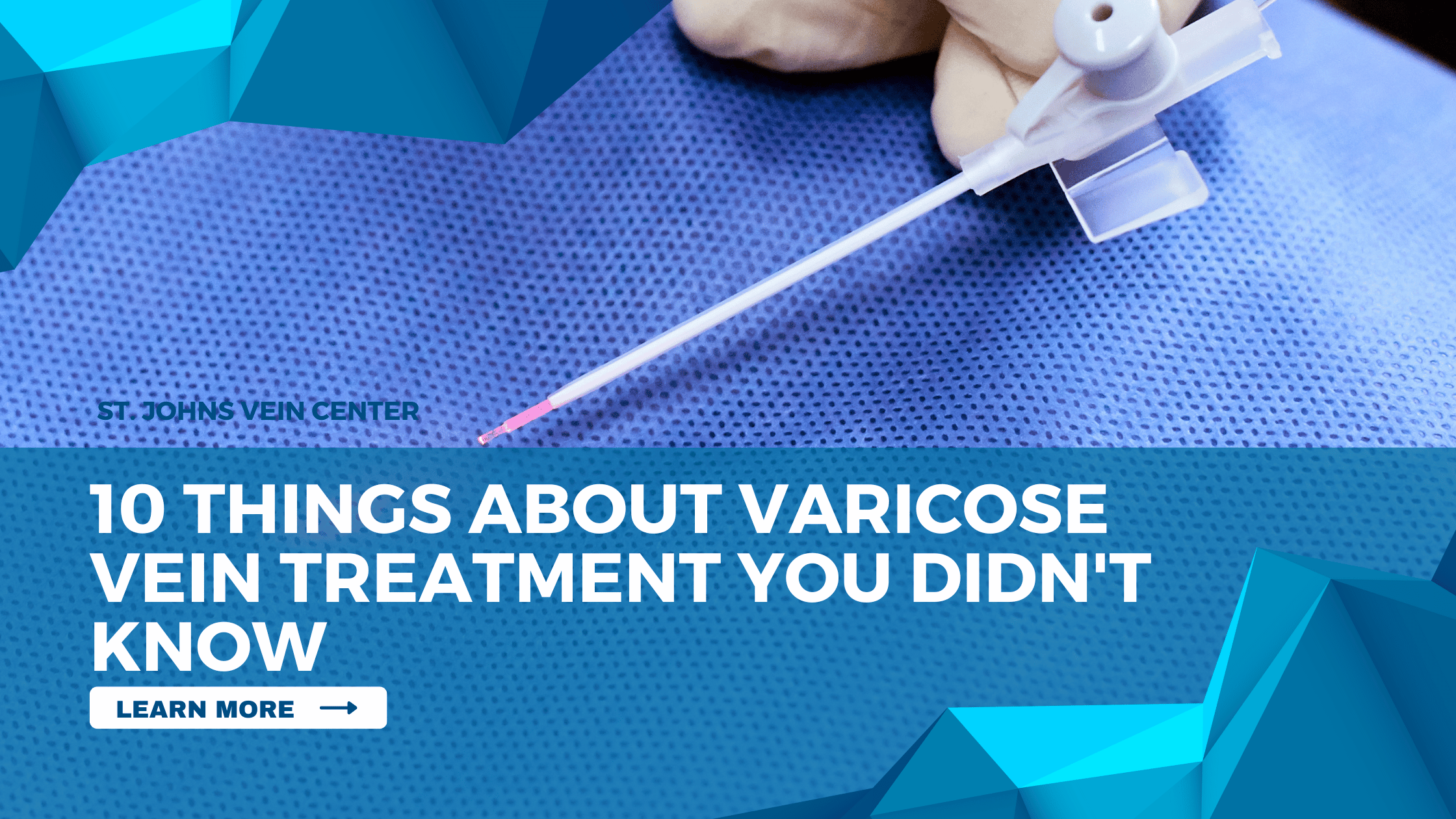 10 Things About Varicose Vein Treatment You Didn't Know