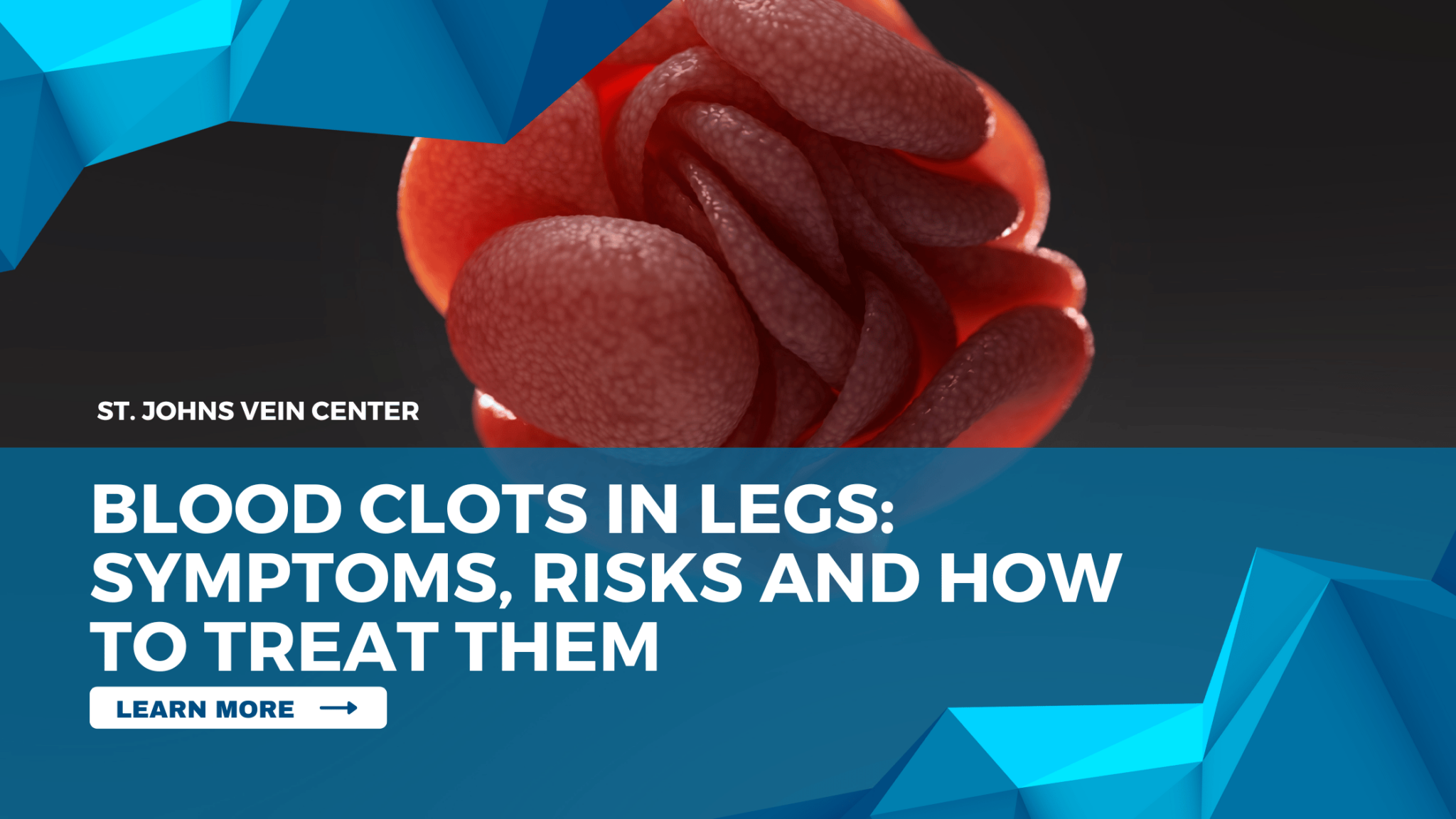 do blood clots travel down the leg