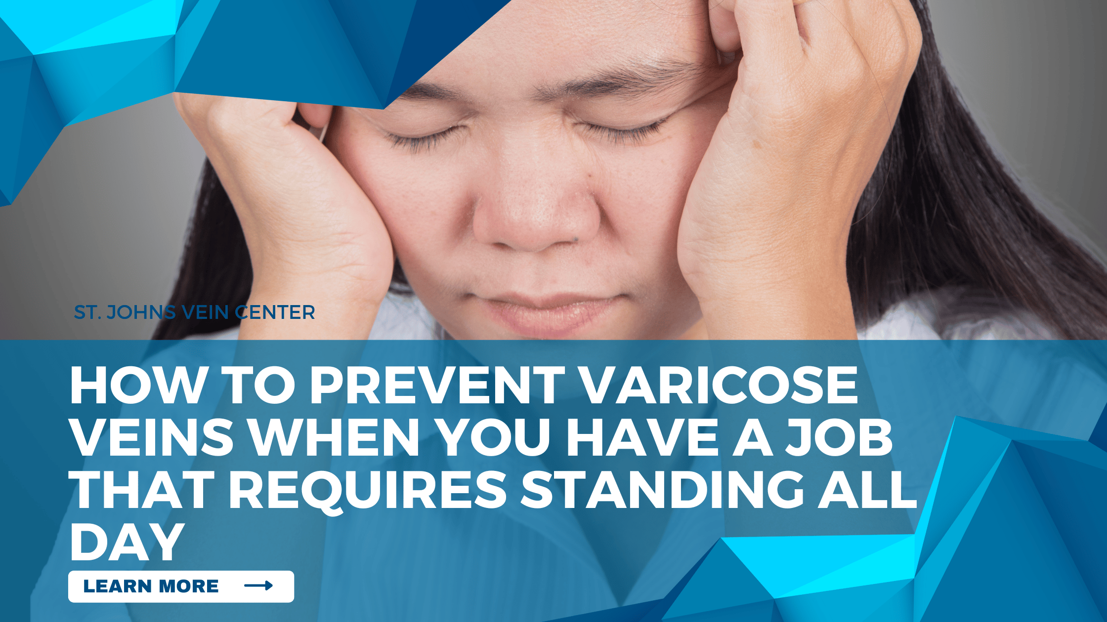 How To Prevent Varicose Veins When You Have A Job That Requires Standing All Day