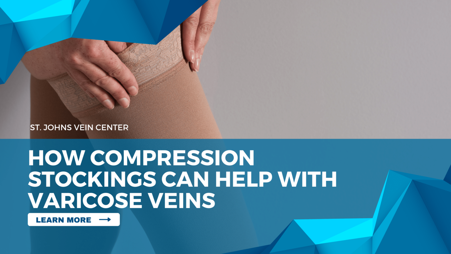 How Compression Stockings Can Help With Varicose Veins St Johns Vein Center 