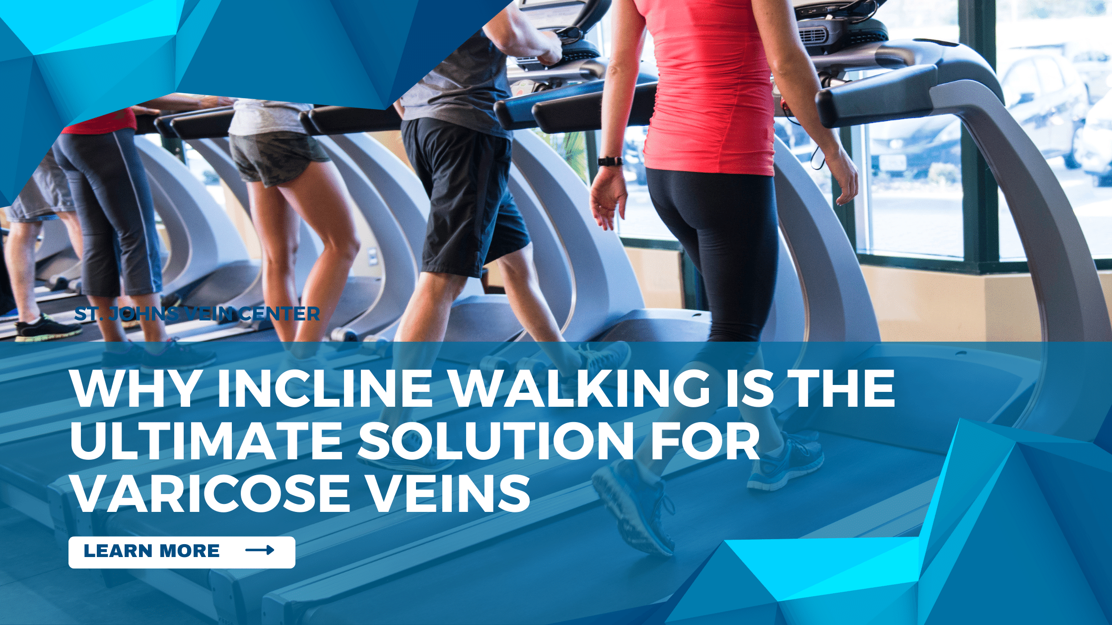 Why Incline Walking is the Ultimate Solution for Varicose Veins