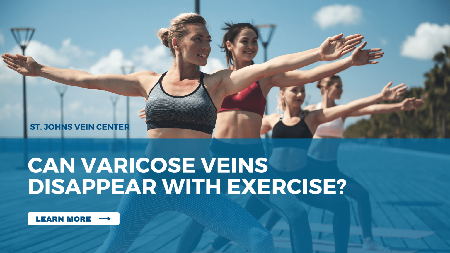 Can Varicose Veins Disappear with Exercise? St Johns Vein Center