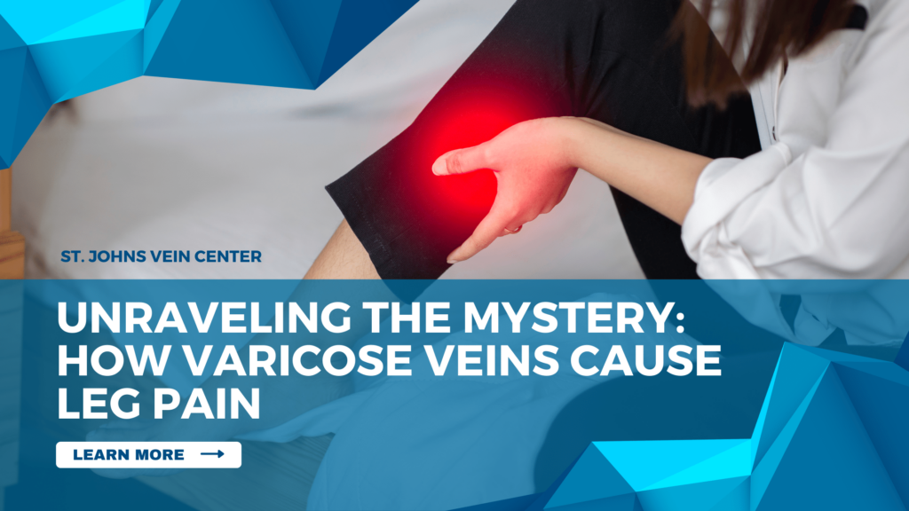 unraveling-the-mystery-how-varicose-veins-cause-leg-pain-st-johns