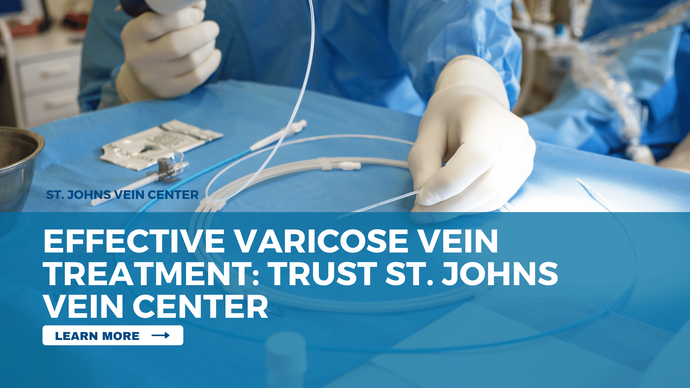 Effective Varicose Vein Treatment Trust St. Johns Vein Center
