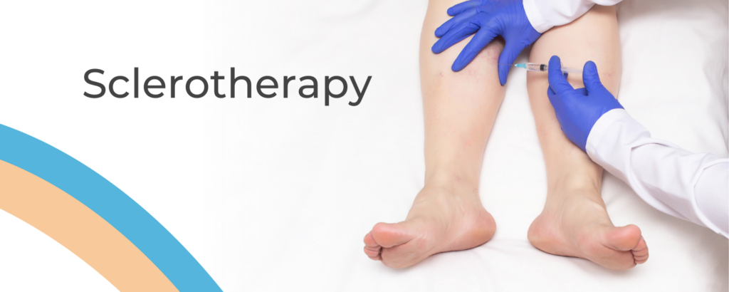 Sclerotherapy Treatment, Ultrasound, Liquid and Foam