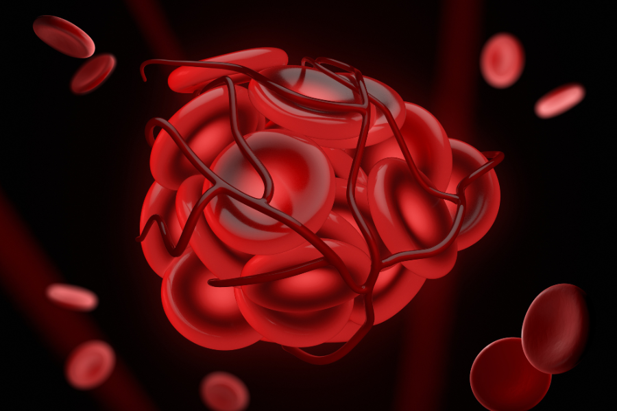 illustration of blood cells forming a clot